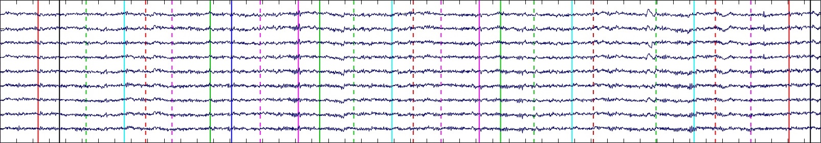 Brainwaves banner